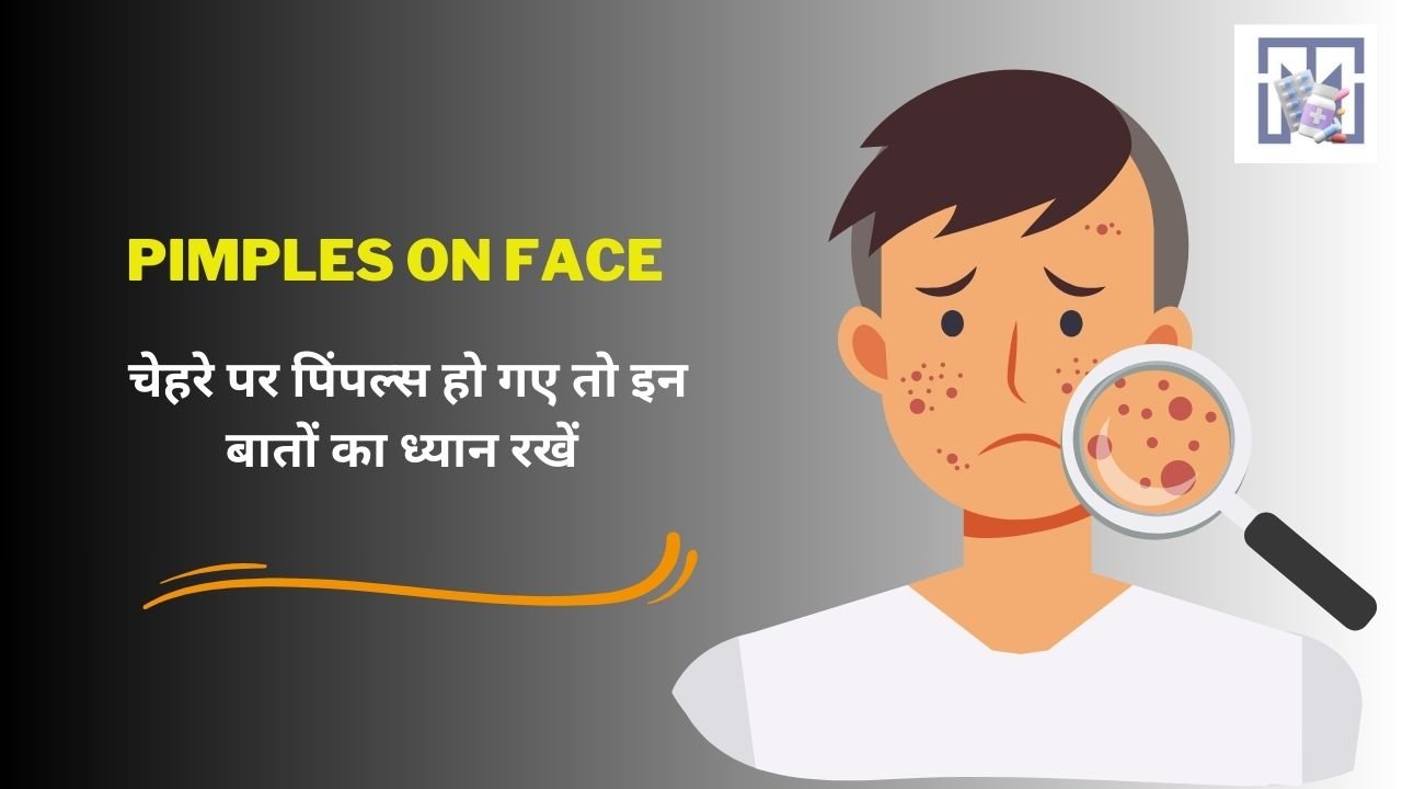 Pimples on Face